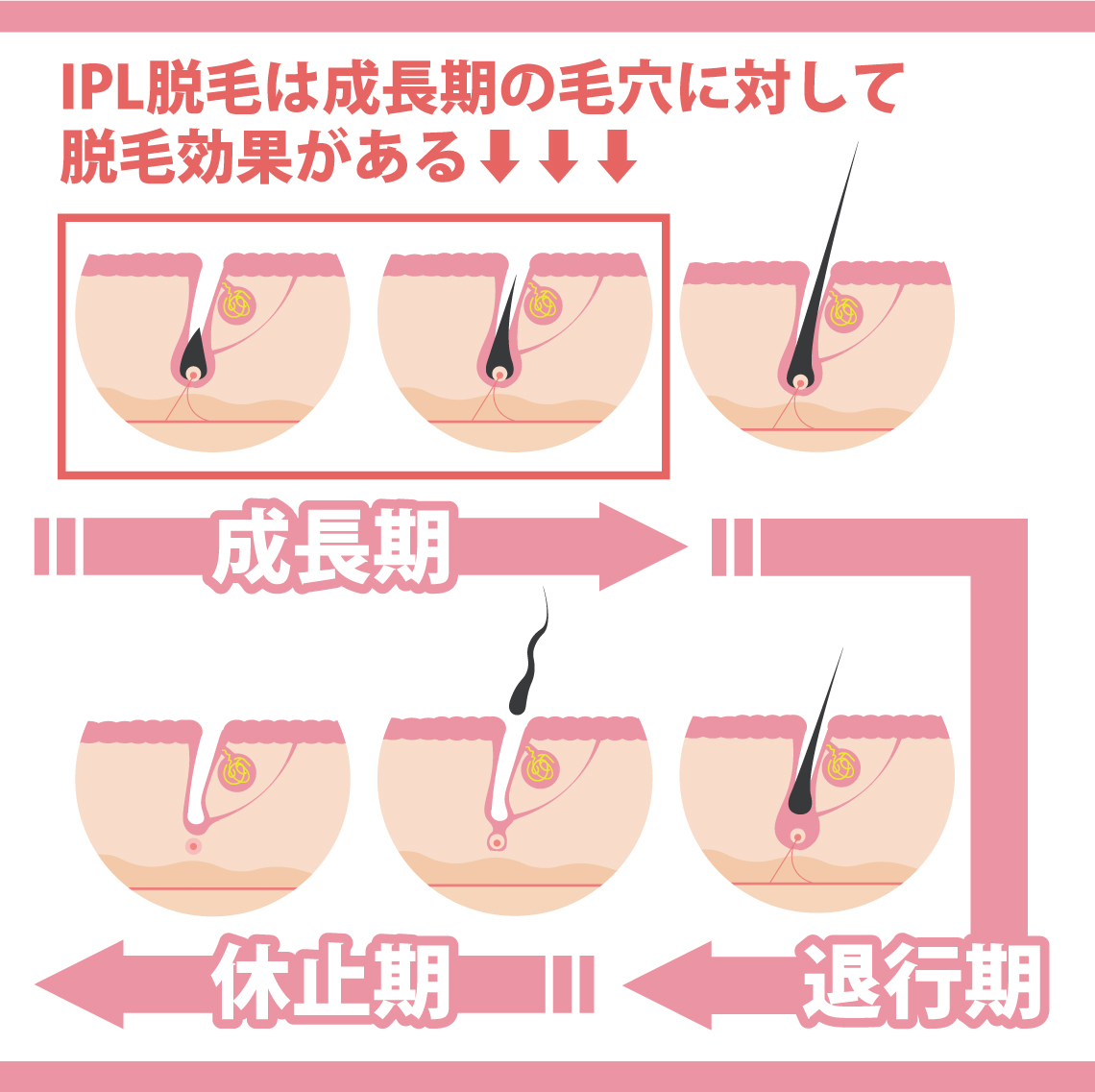 毛穴の仕組み