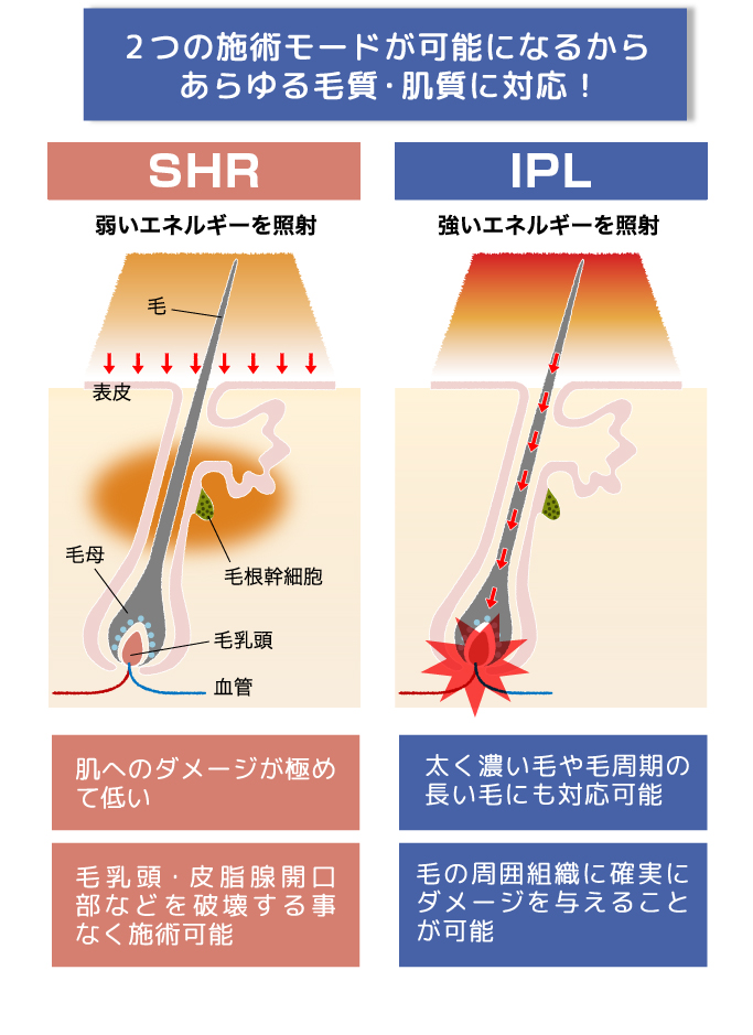 施術モード