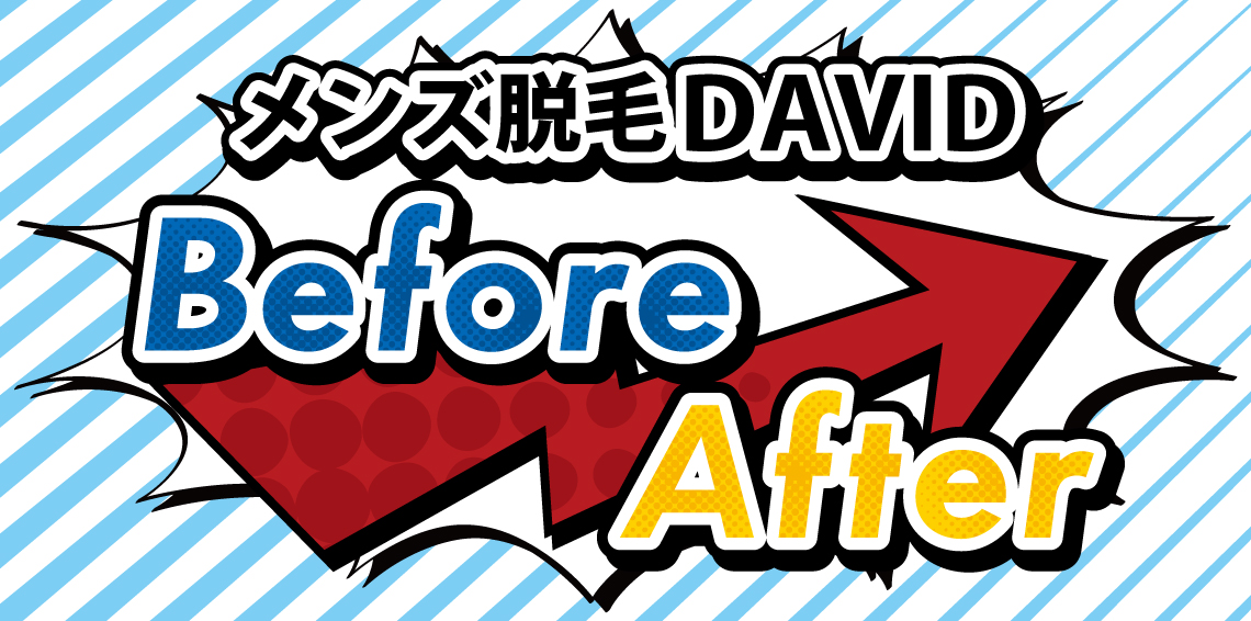 Before-After Before-After