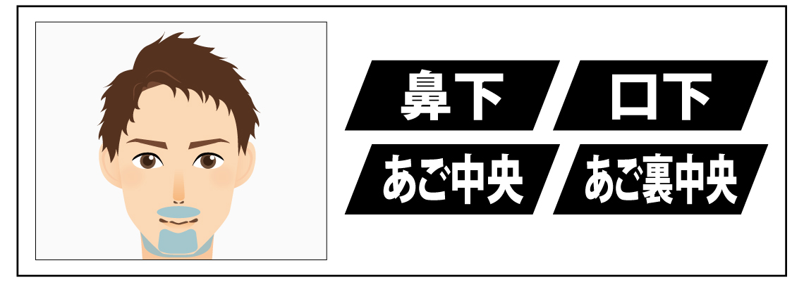 中央のみハイブリッドひげ脱毛_02 中央のみハイブリッドひげ脱毛_02