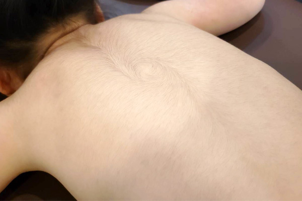 Before(4歳) Before(4歳)